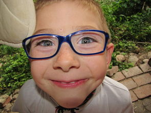 爱心供卵代怀龙凤胎公司：孕妇脸上长斑生完能退吗？
